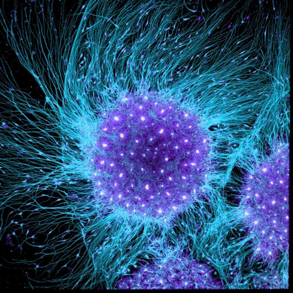 Клетки головного мозга человека, отделенные от эмбриональных стволовых клеток