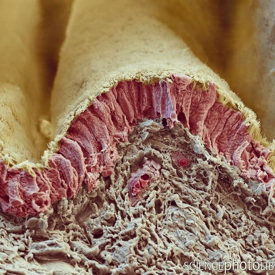 Цветная сканирующая электронная микрофотография среза слизистой оболочки бронхов